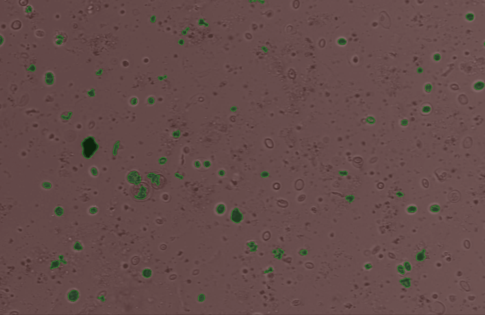 ../../_images/phytoplankton-fluorescence_edit_contours.gif